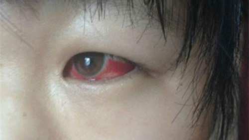 光觸媒除甲醛保護(hù)新裝修教室空氣，更保護(hù)孩子們